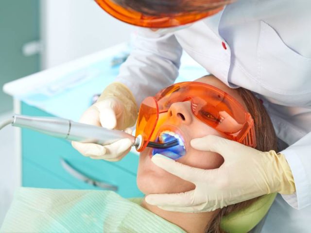 Do’s and Don’ts After Dental Fillings