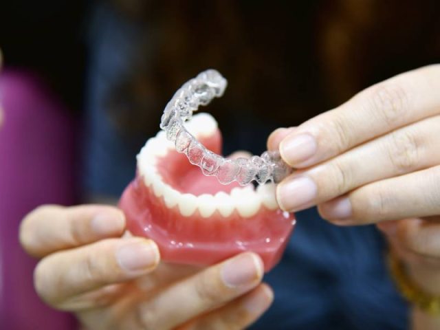 FAQs for Invisalign at London Dental House