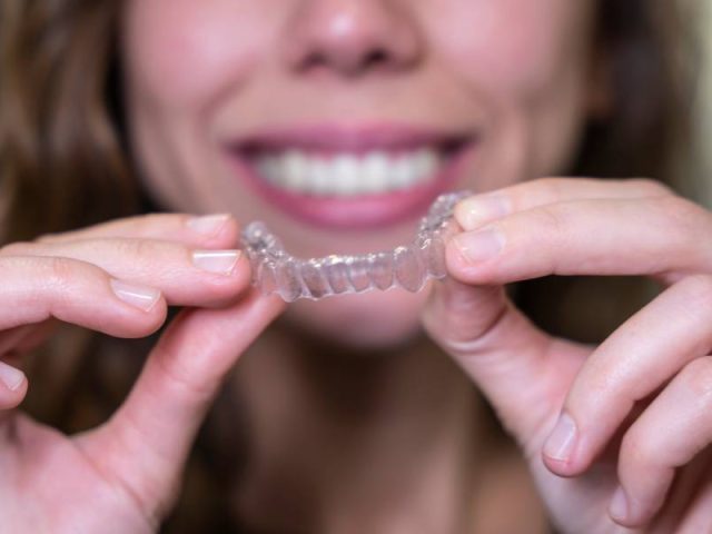 FAQs – Invisalign in London, Ontario