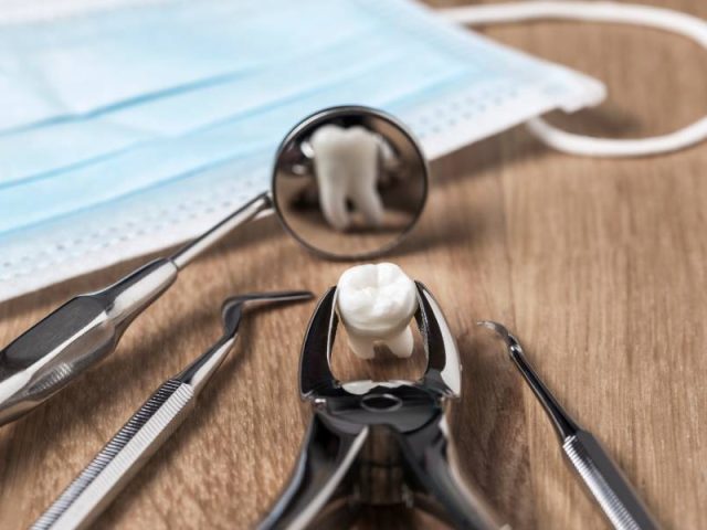 7 Reasons You Need a Tooth Extraction