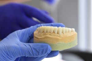 Dental Implants London Ontario