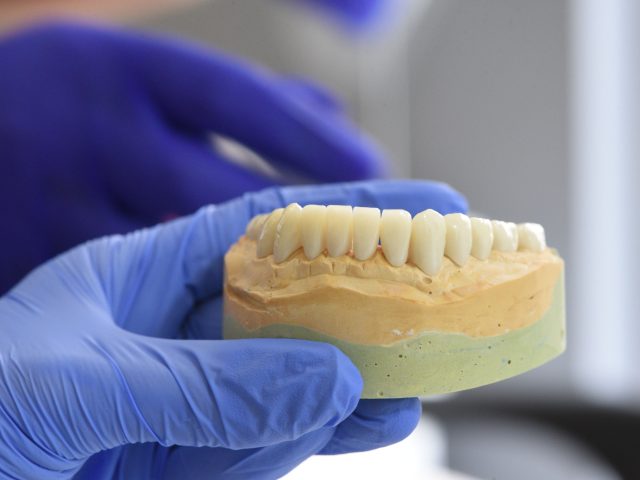 Am I a candidate for dental implants in London, Ontario?